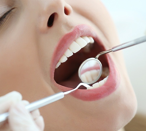 Gum Disease Treatment In Houston TX
